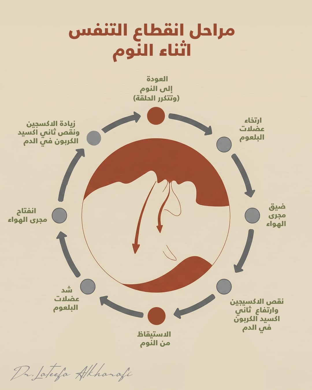 العلاج متعدد التخصصات لانقطاع التنفس أثناء النوم